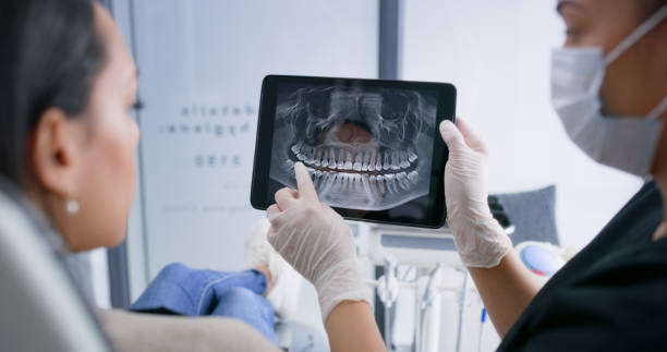 Licensed Tooth Extraction service in North Augusta, SC - Smile Center Dentistry